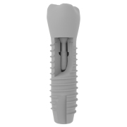 Implant zęba - 3